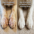 Yeast Infection Drops™